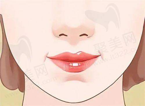 南京美莱整形更厉害三个科室之口腔美容科开展了哪些项目？