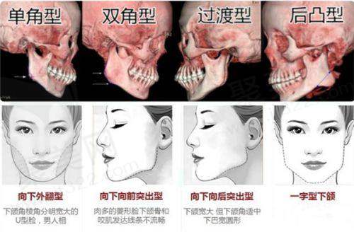 合肥台美整形美容门诊部：专精医生团队助力美丽