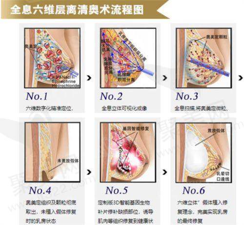 四、北京黄寺整形医院吸脂与乳房整形项目价格及特色