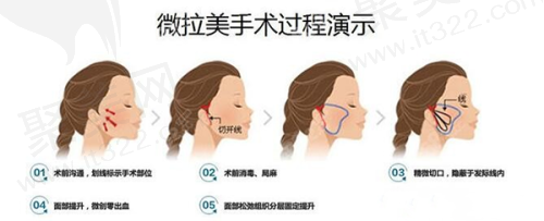 宁德铧媄医疗美容门诊部黄晓玲特色技术优势