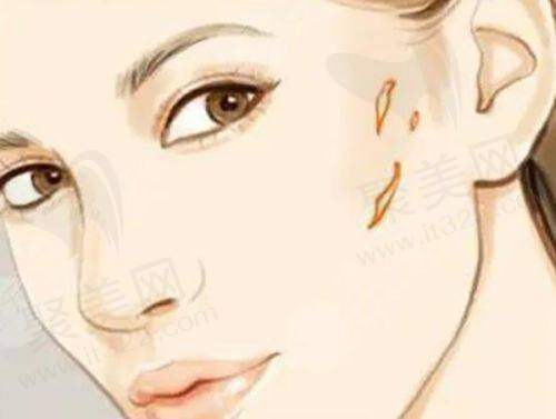 北京星洲医疗美容门诊部：交通路线