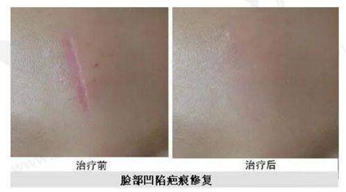 任玉萍医生擅长项目
