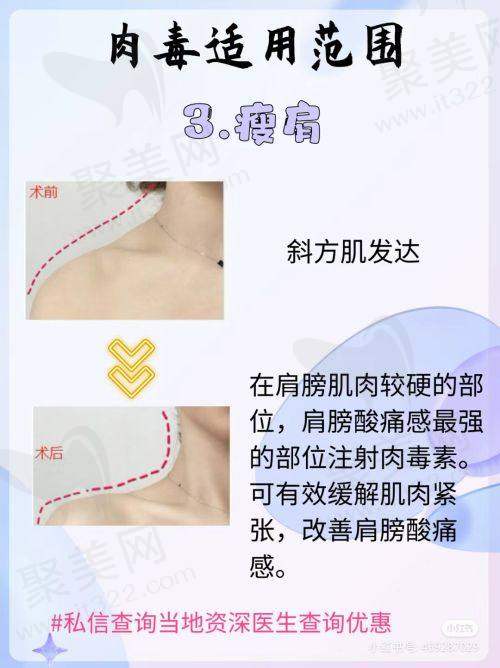北京星洲医疗美容门诊部：正规吗
