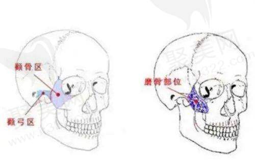 郑州悦容整形医院李戈医生的真实的患者评价如下