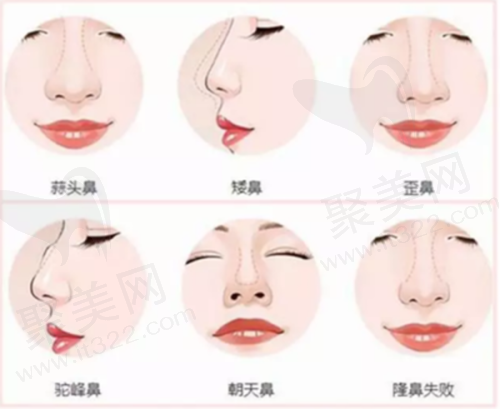 北京星洲医疗美容门诊部：收费价格表