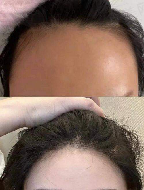 广州荔医整形这家医院靠谱吗?