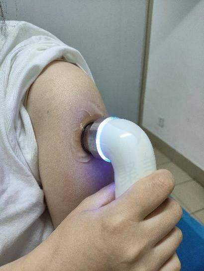 广州荔医李丰霞医生在半岛超声炮全模式项目上有何专长?