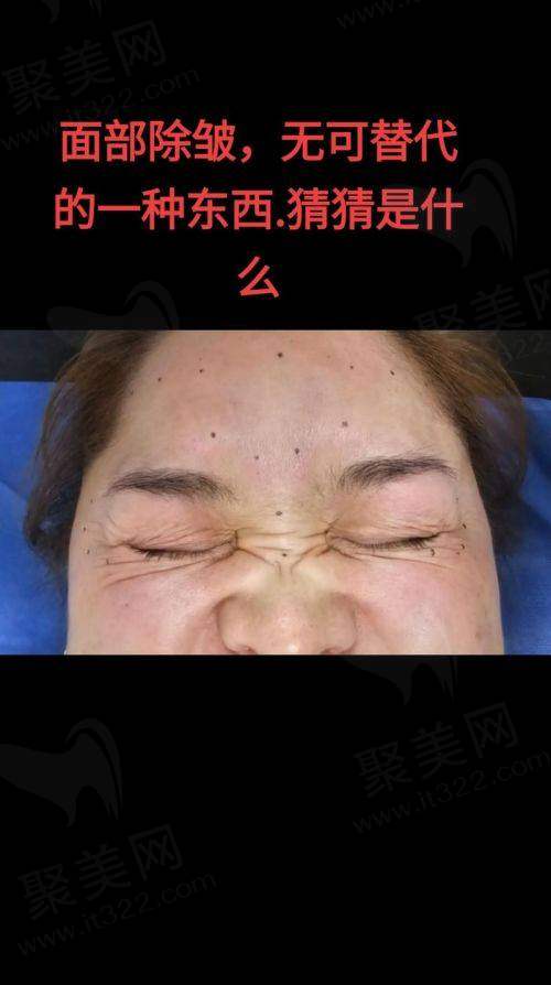 广州荔医医疗美容是一家怎样的医院呢?