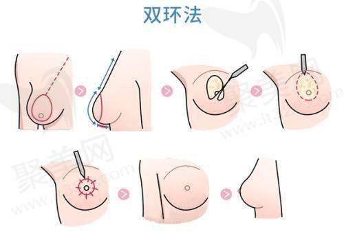 常见问题解答：消除疑虑担忧