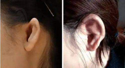 南京美莱夏建军的收费情况透明吗？