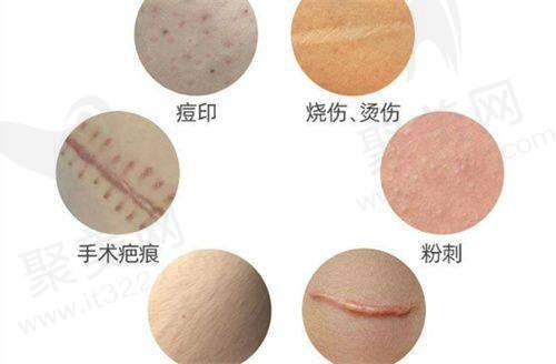 深圳今喜医疗美容吸脂项目全解析
