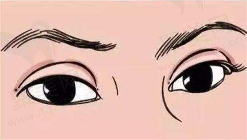 张永医生的审美理念是怎样的？