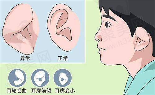 张路：技术灵活的整形实力派