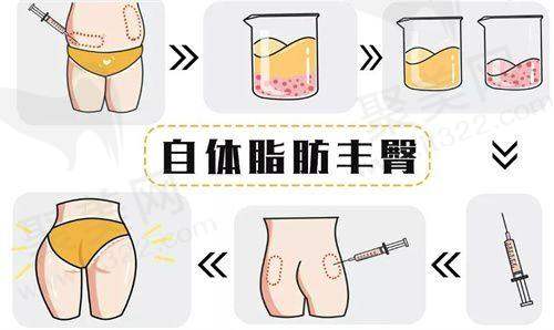 翁超医生擅长项目