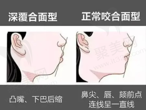 五、上海雅郑口腔门诊部怎么预约：