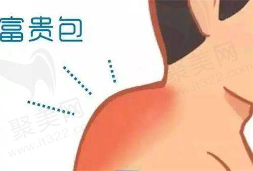 二、深圳曹孟君治疗富贵包的地址及交通指引