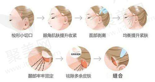 曹德君：经验多的面部整形骨干医生