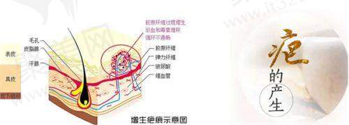 袁捷：专注轮廓整形的匠心医者