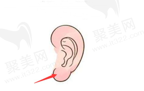 深圳今喜医疗美容吸脂避坑指南