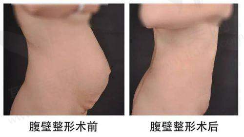 韩国Beulibal整形外科营业时间