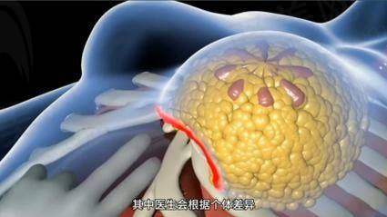 一、隆胸骨干医生李春财简介