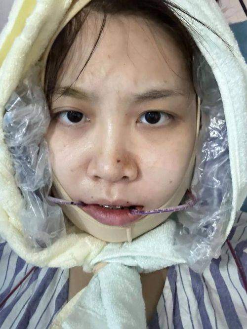 三、朱石江做颌面畸形矫正的优势