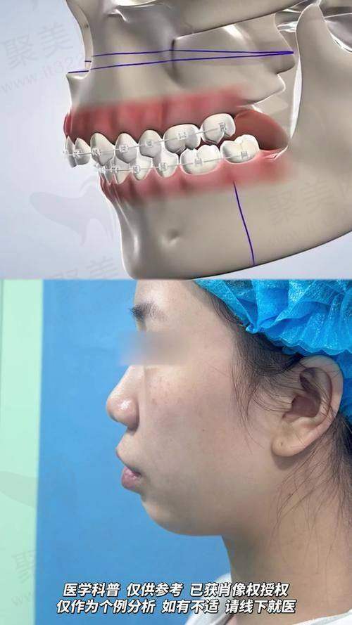 八、总结
