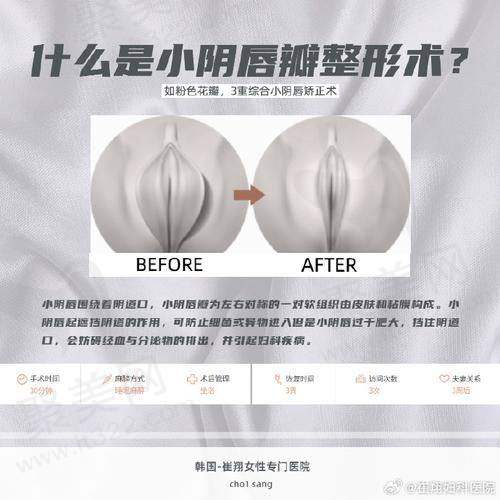 乌鲁木齐华美整形处女膜修复880元起，技术不错保护成效