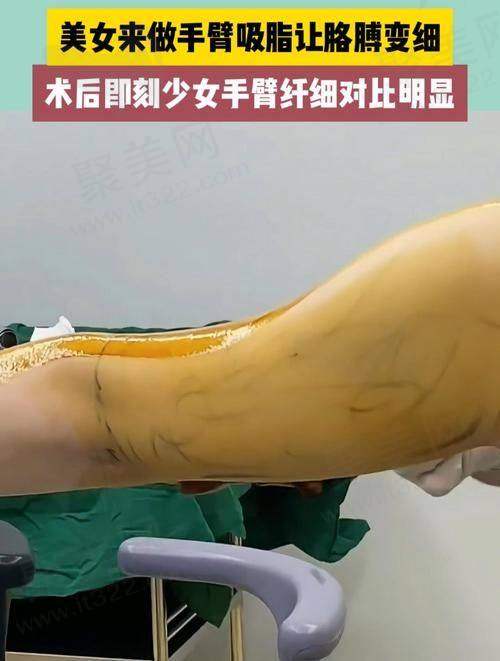 专精定制方案：量身打造专属美