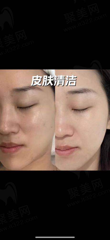 五、辽宁省人民医院——多学科发展的整形之选