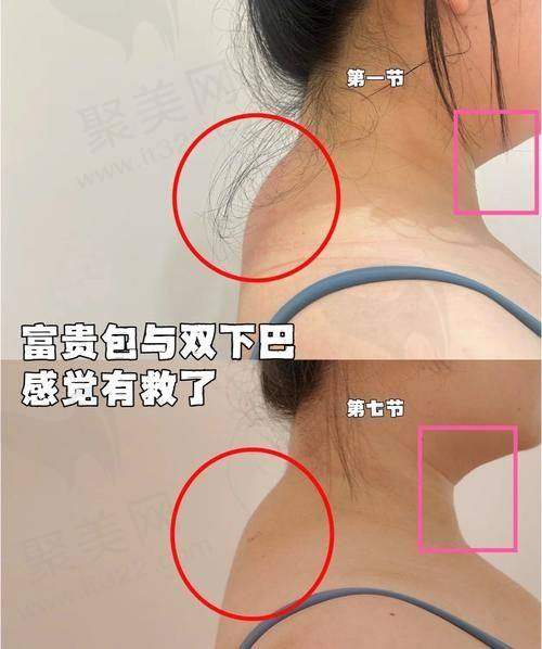 五、深圳曹孟君医疗美容医院的预约方式