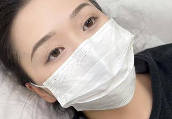 整容失败的女子的结局与反思