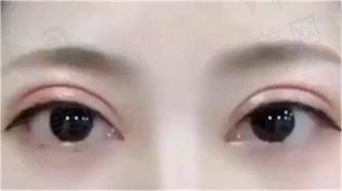 三、廊坊庄艳杰医生技术优势