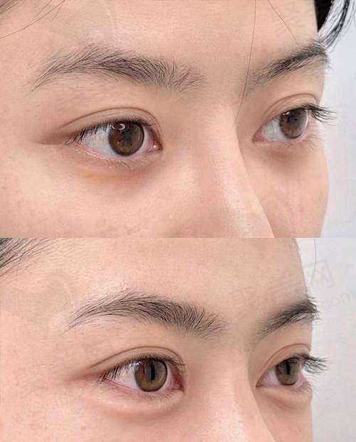 三、深圳福雅医疗美容门诊部骨干医生之胡俊杰医生介绍