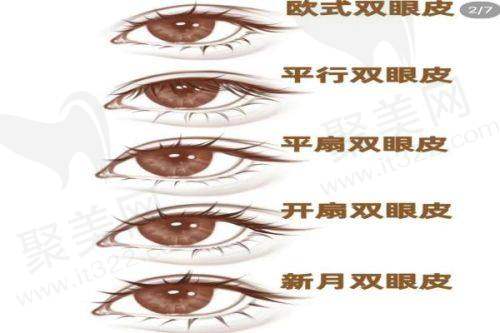 六、易普锋怎么预约？