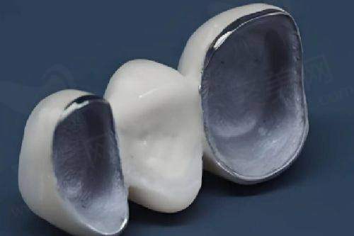 襄阳德派口腔医院低价种牙正畸优势