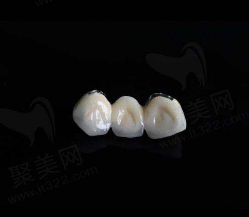 四、天津南开美奥口腔——连锁大鳄搞活动