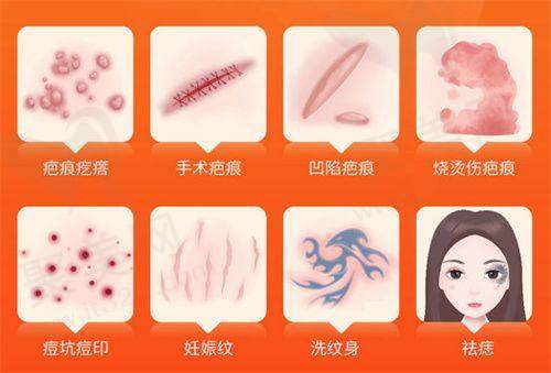 深圳艺星医疗美容医院口碑怎么样？——从特色项目看口碑