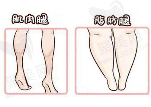 苏州圣爱整形医院更擅长什么之鼻部整形？