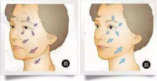 广州壹加壹整形美容医院是连锁医院吗?听听消费者的口碑