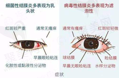 深圳爱尔眼科医院的价格体系：透明合理