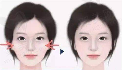 广州壹加壹整形美容医院是连锁医院吗?看医院开展项目情况