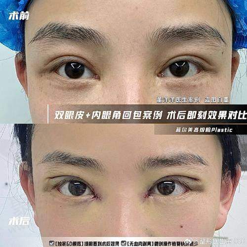 诺美德姜留刚医生的收费情况如何？