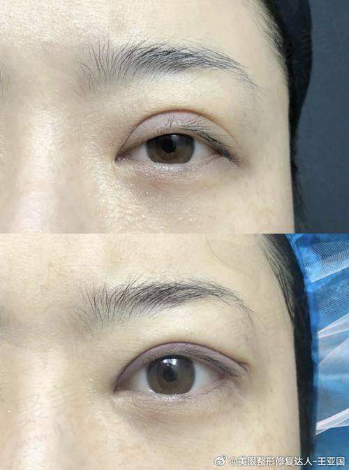 深圳艺星医疗美容医院的整体情况怎样？
