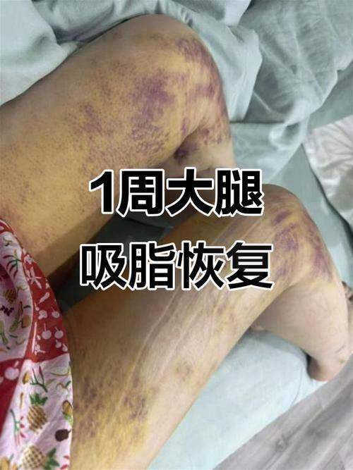 4、杭州丽脂陈旭华医生社会职称
