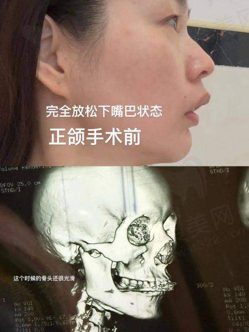 五、李祖兵收费价格表