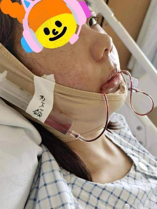 六、李祖兵怎么预约？
