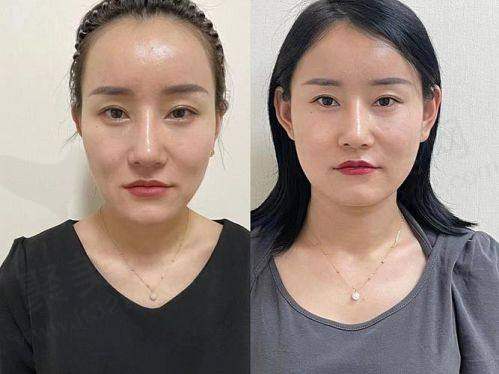 四、深圳伽美贝拉医疗美容诊所海上店怎么预约：