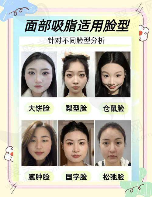 3、杭州丽脂陈旭华医生整形技术怎么样？