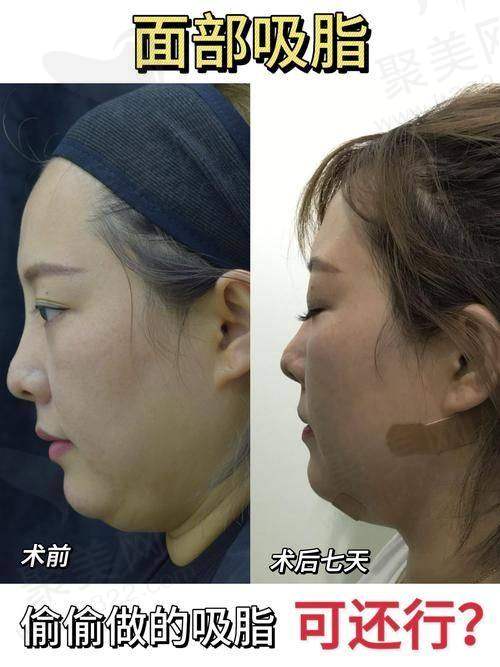 2、杭州丽脂陈旭华医生擅长项目：